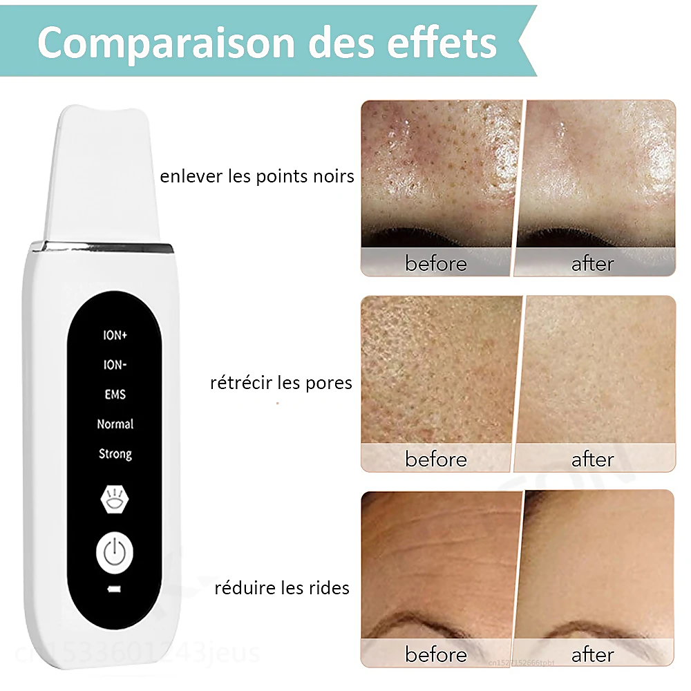 STELLAR - Appareil de Soin Facial 5 en 1 - Exfoliant Lifting EMS à Ultrasons